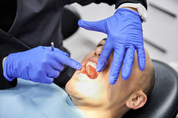 Best Emergency Treatment for Dental Infections or Abscesses in Bryan, TX